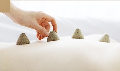 뜸 치료