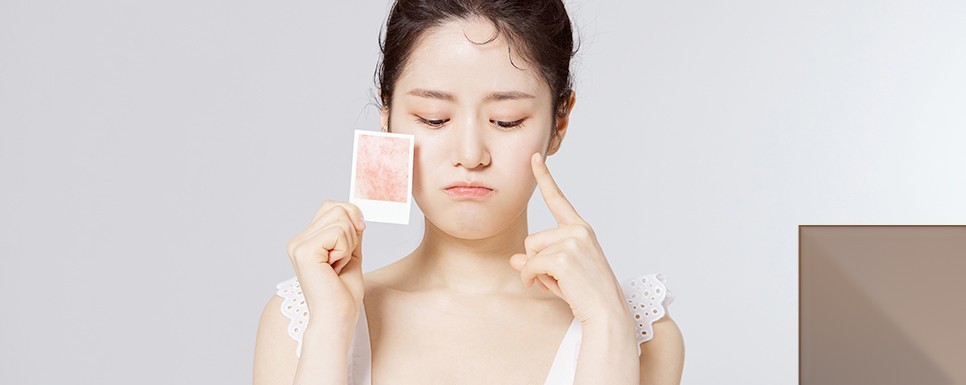 여드름