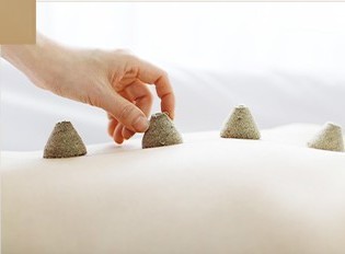 뜸 치료